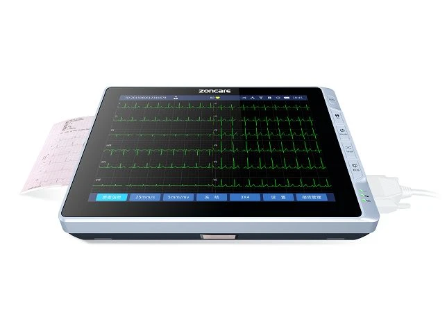 Jó-e hordozható EKG-monitort használni?